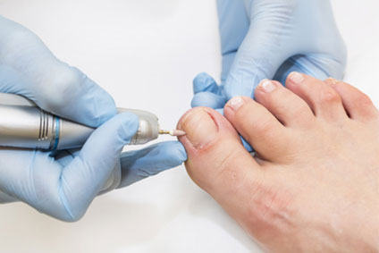 Podologische Nagelbehandlung, Praxis für Podologie in Oer-Erkenschwick